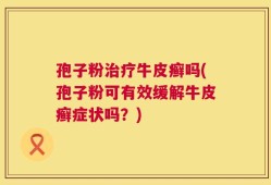 孢子粉治疗牛皮癣吗(孢子粉可有效缓解牛皮癣症状吗？)