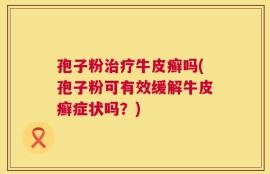 孢子粉治疗牛皮癣吗(孢子粉可有效缓解牛皮癣症状吗？)